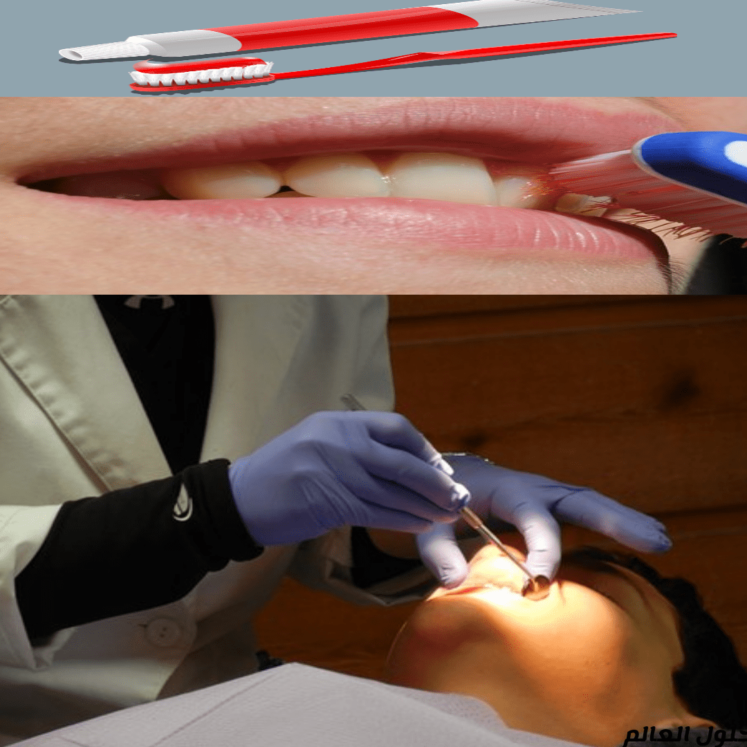 أسئلة وأجوبة عن صحة الفم والأسنان - حلول العالم