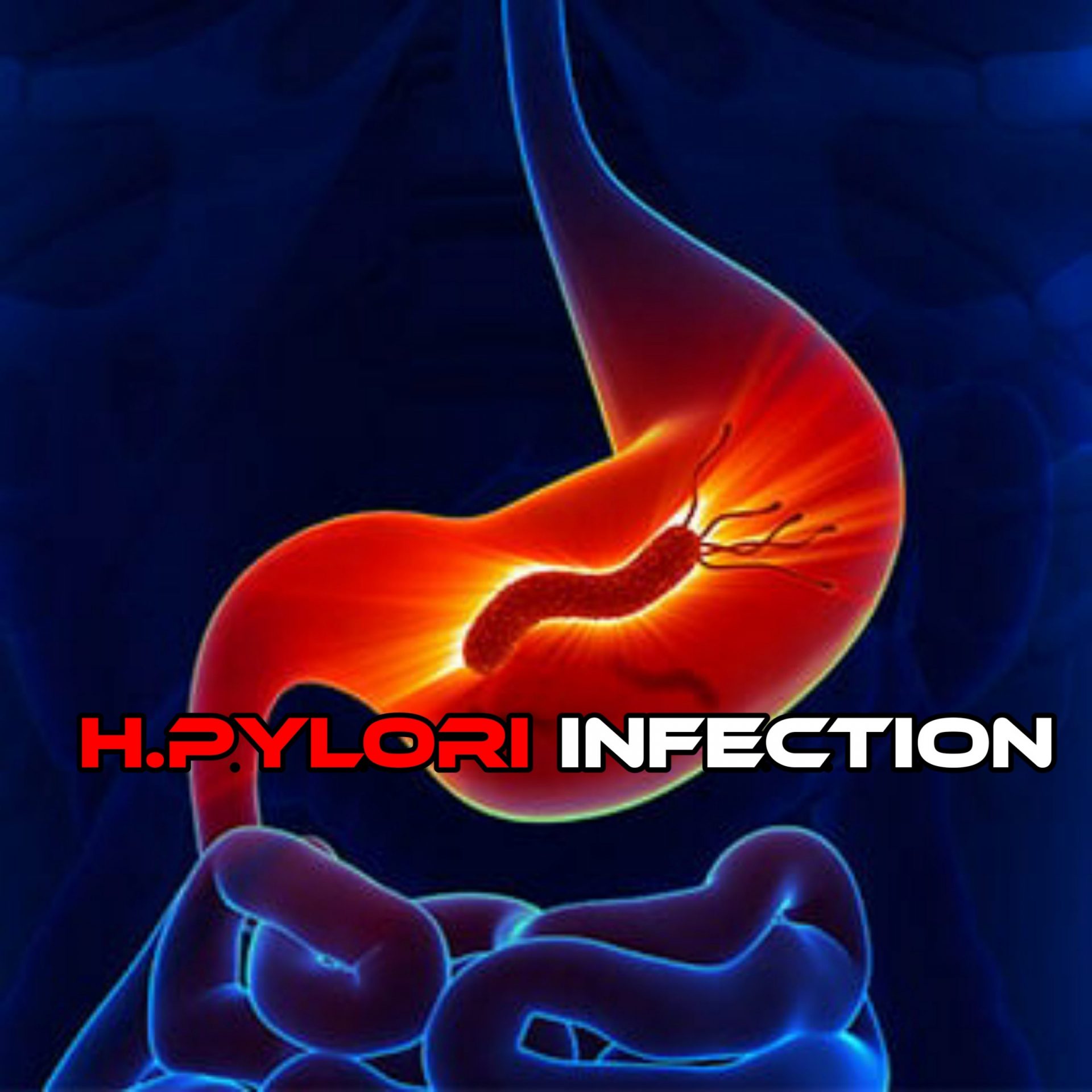 The Infection That effect The Stomach